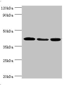 Western blot
All lanes: Mitogen-activated protein kinase 13 antibody at 3ug/ml
Lane 1: HepG2 whole cell lysate
Lane 2: Hela whole cell lysate
Lane 3: MCF-7 whole cell lysate
Secondary
Goat polyclonal to rabbit IgG at 1/10000 dilution
Predicted band size: 43, 29 kDa
Observed band size: 43 kDa