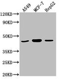 Western Blot
Positive WB detected in: A549 whole cell lysate, MCF-7 whole cell lysate, HepG2 whole cell lysate
All lanes: MAPK14 antibody at 1:2000
Secondary
Goat polyclonal to rabbit IgG at 1/50000 dilution
Predicted band size: 42, 35, 36, 30 kDa
Observed band size: 42 kDa