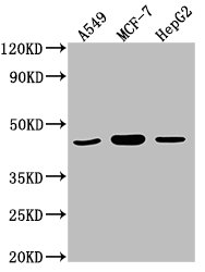 Western Blot
Positive WB detected in: A549 whole cell lysate, MCF-7 whole cell lysate, HepG2 whole cell lysate
All lanes: MAPK14 antibody at 1:2000
Secondary
Goat polyclonal to rabbit IgG at 1/50000 dilution
Predicted band size: 42, 35, 36, 30 kDa
Observed band size: 42 kDa