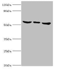 Western blot All lanes: MAPK15 antibody at 6ug/ml Lane 1: Hela whole cell lysate Lane 2: MCF-7 whole cell lysate Lane 3: HepG2 whole cell lysate Secondary Goat polyclonal to rabbit IgG at 1/10000 dilution Predicted band size: 60, 29, 32 kDa Observed band size: 60 kDa