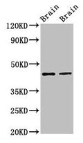 Western Blot
Positive WB detected in: Rat brain tissue, Mouse brain tissue
All lanes: MAPK3 antibody at 3µg/ml
Secondary
Goat polyclonal to rabbit IgG at 1/50000 dilution
Predicted band size: 44, 39, 41 kDa
Observed band size: 44 kDa