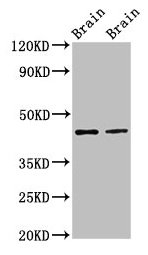 Western Blot
Positive WB detected in: Rat brain tissue, Mouse brain tissue
All lanes: MAPK3 antibody at 3µg/ml
Secondary
Goat polyclonal to rabbit IgG at 1/50000 dilution
Predicted band size: 44, 39, 41 kDa
Observed band size: 44 kDa