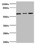 Western blot All lanes: MAPK4 ntibody at 6ug/ml Lane 1: Mouse brain tissue Lane 2: 293T whole cell lysate Lane 3: Jurkat whole cell lysate Secondary Goat polyclonal to rabbit IgG at 1/10000 dilution Predicted band size: 66 kDa Observed band size: 66 kDa