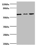 Western blot All lanes: MAPK4 ntibody at 6ug/ml Lane 1: Mouse brain tissue Lane 2: 293T whole cell lysate Lane 3: Jurkat whole cell lysate Secondary Goat polyclonal to rabbit IgG at 1/10000 dilution Predicted band size: 66 kDa Observed band size: 66 kDa
