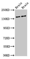 Western Blot
Positive WB detected in: Rat brain tissue, Mouse brain tissue
All lanes: MAST3 antibody at 3ug/ml
Secondary
Goat polyclonal to rabbit IgG at 1/50000 dilution
Predicted band size: 144 kDa
Observed band size: 144 kDa
