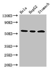 Western Blot
Positive WB detected in: Hela whole cell lysate, HepG2 whole cell lysate, Mouse stomach tissue
All lanes: MDM4 antibody at 3µg/ml
Secondary
Goat polyclonal to rabbit IgG at 1/50000 dilution
Predicted band size: 55, 15, 14, 19, 50 kDa
Observed band size: 55 kDa