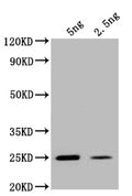 Western Blot
Positive WB detected in: recombinant protein
All lanes: ogt Antibody at 1:1000
Secondary
Goat polyclonal to rabbit IgG at 1/50000 dilution
Predicted band size: 25 kDa
Observed band size: 25 kDa