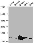 Western Blot
Positive WB detected in: Mouse Liver tissue, Mouse Spleen tissue, Mouse kidney tissue, Mouse Brain tissue, Hela whole cell lysate
All lanes: Mif antibody at 1:2000
Secondary
Goat polyclonal to rabbit IgG at 1/50000 dilution
Predicted band size: 13 kDa
Observed band size: 13 kDa