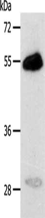 Gel: 10%SDS-PAGE, Lysate: 30 ug, Lane: Human liver cancer tissue, Primary antibody: CSB-PA013884(CA14 Antibody) at dilution 1/400, Secondary antibody: Goat anti rabbit IgG at 1/8000 dilution, Exposure time: 20 seconds