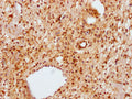 IHC image of CSB-PA014595LA01HU diluted at 1:100 and staining in paraffin-embedded human skin tissue performed on a Leica BondTM system. After dewaxing and hydration, antigen retrieval was mediated by high pressure in a citrate buffer (pH 6.0). Section was blocked with 10% normal goat serum 30min at RT. Then primary antibody (1% BSA) was incubated at 4°C overnight. The primary is detected by a Goat anti-rabbit polymer IgG labeled by HRP and visualized using 0.05% DAB.