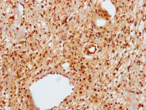 IHC image of CSB-PA014595LA01HU diluted at 1:100 and staining in paraffin-embedded human skin tissue performed on a Leica BondTM system. After dewaxing and hydration, antigen retrieval was mediated by high pressure in a citrate buffer (pH 6.0). Section was blocked with 10% normal goat serum 30min at RT. Then primary antibody (1% BSA) was incubated at 4°C overnight. The primary is detected by a Goat anti-rabbit polymer IgG labeled by HRP and visualized using 0.05% DAB.