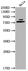 Western Blot
Positive WB detected in: Hela whole cell lysate
All lanes: Mmp2 antibody at 1:2000
Secondary
Goat polyclonal to rabbit IgG at 1/50000 dilution
Predicted band size: 75, 66 kDa
Observed band size: 75 kDa
