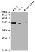 Western Blot
Positive WB detected in: MCF-7 whole cell lysate, PC-3 whole cell lysate, Mouse Liver tissue
All lanes: MOCS3 antibody at 1:2000
Secondary
Goat polyclonal to rabbit IgG at 1/50000 dilution
Predicted band size: 50 kDa
Observed band size: 50 kDa
