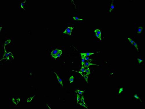 Immunofluorescence staining of MCF-7 cells with CSB-PA014781LA01HU at 1:100, counter-stained with DAPI. The cells were fixed in 4% formaldehyde and blocked in 10% normal Goat Serum. The cells were then incubated with the antibody overnight at 4°C. The secondary antibody was Alexa Fluor 488-congugated AffiniPure Goat Anti-Rabbit IgG(H+L).