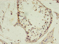 MSH6 Antibody, HRP conjugated – Figure 1 of 3