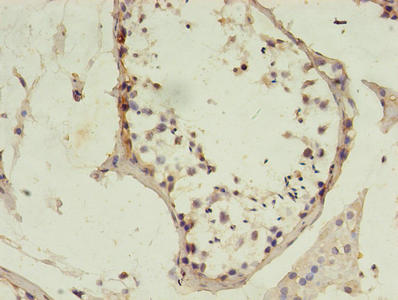 MSH6 Antibody, FITC conjugated – Figure 1 of 3