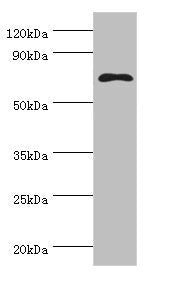 Western blot All lanes: MSLN antibody at 8µg/ml + Hela whole cell lysate Secondary Goat polyclonal to rabbit IgG at 1/10000 dilution Predicted band size: 69, 72, 68 kDa Observed band size: 69 kDa