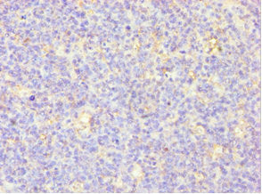 Immunohistochemistry of paraffin-embedded human tonsil tissue using CSB-PA015044ESR2HU at dilution of 1:100