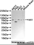 Western Blot
Positive WB detected in: A549 whole cell lysate, NIH/3T3 whole cell lysate, Hela whole cell lysate
All lanes: MX1 antibody at 3ug/ml
Secondary
Goat polyclonal to rabbit IgG at 1/50000 dilution
Predicted band size: 76, 56 kDa
Observed band size: 76 kDa