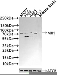 Western Blot
Positive WB detected in: A549 whole cell lysate, NIH/3T3 whole cell lysate, Hela whole cell lysate
All lanes: MX1 antibody at 3ug/ml
Secondary
Goat polyclonal to rabbit IgG at 1/50000 dilution
Predicted band size: 76, 56 kDa
Observed band size: 76 kDa