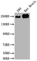 Western Blot
Positive WB detected in: 293 whole cell lysate, Rat Brain tissue
All lanes: MYH10 antibody at 1:2000
Secondary
Goat polyclonal to rabbit IgG at 1/50000 dilution
Predicted band size: 229, 231, 232, 233 kDa
Observed band size: 250 kDa