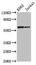 Western Blot
Positive WB detected in: K562 whole cell lysate, Jurkat whole cell lysate
All lanes: NAMPT antibody at 2.7µg/ml
Secondary
Goat polyclonal to rabbit IgG at 1/50000 dilution
Predicted band size: 56 kDa
Observed band size: 56 kDa