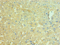 Immunohistochemistry of paraffin-embedded human liver tissue using CSB-PA015422ESR1HU at dilution of 1:100