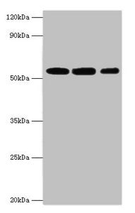 Western blot
All lanes: Nicotinamide phosphoribosyltransferase antibody at 4ug/ml
Lane 1: Mouse heart tissue
Lane 2: Mouse liver tissue
Lane 3: Mouse skeletal muscle tissue
Secondary
Goat polyclonal to rabbit IgG at 1/10000 dilution
Predicted band size: 56 kDa
Observed band size: 56 kDa