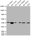 Western Blot
Positive WB detected in: Rat Heart tissue, Rat Liver tissue, Rat Spleen tissue, Rat Kidney tissue, Rat Brain tissue, Hela whole cell lysate
All lanes: Nampt antibody at 1:2000
Secondary
Goat polyclonal to rabbit IgG at 1/50000 dilution
Predicted band size: 56 kDa
Observed band size: 56 kDa