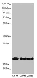 Western blot All lanes: NDUFB10 antibody at 2.42µg/ml Lane 1: Mouse brain tissue Lane 2: HepG2 whole cell lysate Lane 3: 293T whole cell lysate Secondary Goat polyclonal to rabbit IgG at 1/10000 dilution Predicted band size: 21 kDa Observed band size: 21 kDa