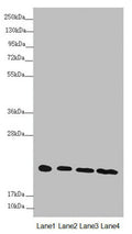 Western blot All lanes: NDUFB10 antibody at 3.04 ug/ml Lane 1: Hela whole cell lysate Lane 2: Jurkat whole cell lysate Lane 3: HepG2 whole cell lysate Lane 4: 293T whole cell lysate Secondary Goat polyclonal to rabbit IgG at 1/10000 dilution Predicted band size: 21 kDa Observed band size: 21 kDa
