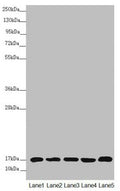 Western blot All lanes: NDUFB5 antibody at 2.64µg/ml Lane 1: Mouse heart tissue Lane 2: Mouse kidney tissue Lane 3: 293T whole cell lysate Lane 4: Jurkat whole cell lysate Lane 5: MCF-7 whole cell lysate Secondary Goat polyclonal to rabbit IgG at 1/10000 dilution Predicted band size: 22, 16 kDa Observed band size: 16 kDa