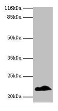 NDUFB5 Antibody, Biotin conjugated – Figure 1 of 1