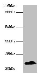 NDUFB5 Antibody, Biotin conjugated – Figure 1 of 1
