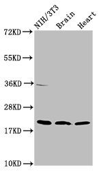 Western Blot
Positive WB detected in: NIH/3T3 whole cell lysate, Rat brain tissue, Mouse heart tissue
All lanes: NDUFB8 antibody at 2ug/ml
Secondary
Goat polyclonal to rabbit IgG at 1/50000 dilution
Predicted band size: 22, 21, 19 kDa
Observed band size: 22 kDa