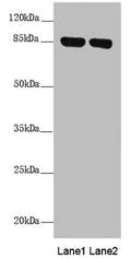 Western blot All lanes: NDUFS1 antibody at 2.41 ug/ml Lane 1: Mouse heart tissue Lane 2: Mouse kidney tissue Secondary Goat polyclonal to rabbit IgG at 1/10000 dilution Predicted band size: 80, 81, 68, 74, 76 kDa Observed band size: 80 kDa