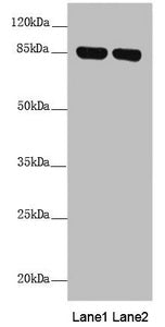Western blot All lanes: NDUFS1 antibody at 2.41 ug/ml Lane 1: Mouse heart tissue Lane 2: Mouse kidney tissue Secondary Goat polyclonal to rabbit IgG at 1/10000 dilution Predicted band size: 80, 81, 68, 74, 76 kDa Observed band size: 80 kDa