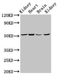 Western Blot
Positive WB detected in: Rat kidney tissue, Mouse heart tissue, Mouse brain tissue, Mouse kidney tissue
All lanes: NDUFS2 antibody at 6.9ug/ml
Secondary
Goat polyclonal to rabbit IgG at 1/50000 dilution
Predicted band size: 53, 52 kDa
Observed band size: 53 kDa