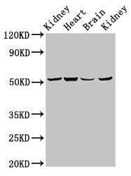 Western Blot
Positive WB detected in: Rat kidney tissue, Mouse heart tissue, Mouse brain tissue, Mouse kidney tissue
All lanes: NDUFS2 antibody at 6.9ug/ml
Secondary
Goat polyclonal to rabbit IgG at 1/50000 dilution
Predicted band size: 53, 52 kDa
Observed band size: 53 kDa