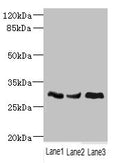 Western blot All lanes: NDUFS3 antibody at 1.98ug/ml Lane 1: Mouse brain tissue Lane 2: Mouse skeletal muscle tissue Lane 3: Mouse heart tissue Secondary Goat polyclonal to rabbit IgG at 1/10000 dilution Predicted band size: 31, 15 kDa Observed band size: 31 kDa