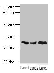 Western blot All lanes: NDUFS3 antibody at 1.98ug/ml Lane 1: Mouse brain tissue Lane 2: Mouse skeletal muscle tissue Lane 3: Mouse heart tissue Secondary Goat polyclonal to rabbit IgG at 1/10000 dilution Predicted band size: 31, 15 kDa Observed band size: 31 kDa