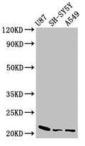 Western Blot
Positive WB detected in: U87 whole cell lysate, SH-SY5Y whole cell lysate, A549 whole cell lysate
All lanes: NDUFS4 antibody at 2.5µg/ml
Secondary
Goat polyclonal to rabbit IgG at 1/50000 dilution
Predicted band size: 21 kDa
Observed band size: 21 kDa