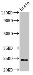 Western Blot
Positive WB detected in: Rat brain tissue
All lanes: NDUFS8 antibody at 2.7ug/ml
Secondary
Goat polyclonal to rabbit IgG at 1/50000 dilution
Predicted band size: 24 kDa
Observed band size: 24 kDa