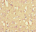 Immunohistochemistry of paraffin-embedded human brain tissue using CSB-PA015688LA01HU at dilution of 1:100