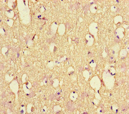 Immunohistochemistry of paraffin-embedded human brain tissue using CSB-PA015688LA01HU at dilution of 1:100