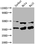 Western Blot
Positive WB detected in: Jurkat whole cell lysate, Hela whole cell lysate, Raji whole cell lysate
All lanes: NFKBIA antibody at 1:2000
Secondary
Goat polyclonal to rabbit IgG at 1/50000 dilution
Predicted band size: 36 kDa
Observed band size: 36 kDa