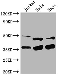 Western Blot
Positive WB detected in: Jurkat whole cell lysate, Hela whole cell lysate, Raji whole cell lysate
All lanes: NFKBIA antibody at 1:2000
Secondary
Goat polyclonal to rabbit IgG at 1/50000 dilution
Predicted band size: 36 kDa
Observed band size: 36 kDa
