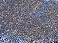 The image on the left is immunohistochemistry of paraffin-embedded Human tonsil tissue using CSB-PA015892(AGFG1 Antibody) at dilution 1/60, on the right is treated with fusion protein. (Original magnification: ×200)