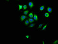 Immunofluorescence staining of A549 cells with CSB-PA015943LA01HU at 1:166, counter-stained with DAPI. The cells were fixed in 4% formaldehyde, permeabilized using 0.2% Triton X-100 and blocked in 10% normal Goat Serum. The cells were then incubated with the antibody overnight at 4°C. The secondary antibody was Alexa Fluor 488-congugated AffiniPure Goat Anti-Rabbit IgG(H+L).