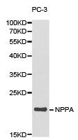 Western blot analysis of extracts of PC-3 cell lines, using NPPA antibody.